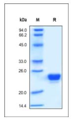 Human Lipocalin-2, His Tag on SDS-PAGE under reducing (R) condition. The gel was stained overnight with Coomassie Blue. The purity of the protein is greater than 95%.